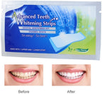 7-Day Smile Boost Whitening Strip Set
