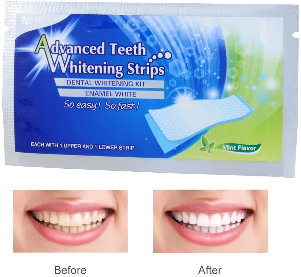 7-Day Smile Boost Whitening Strip Set
